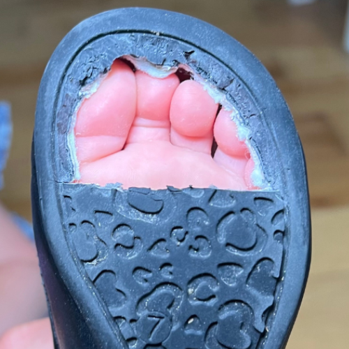 Regular toddler shoe sole worn through